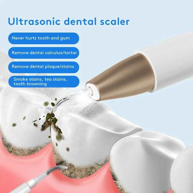 Gold-finish ultrasonic tooth cleaning device for removing tartar and surface stains.