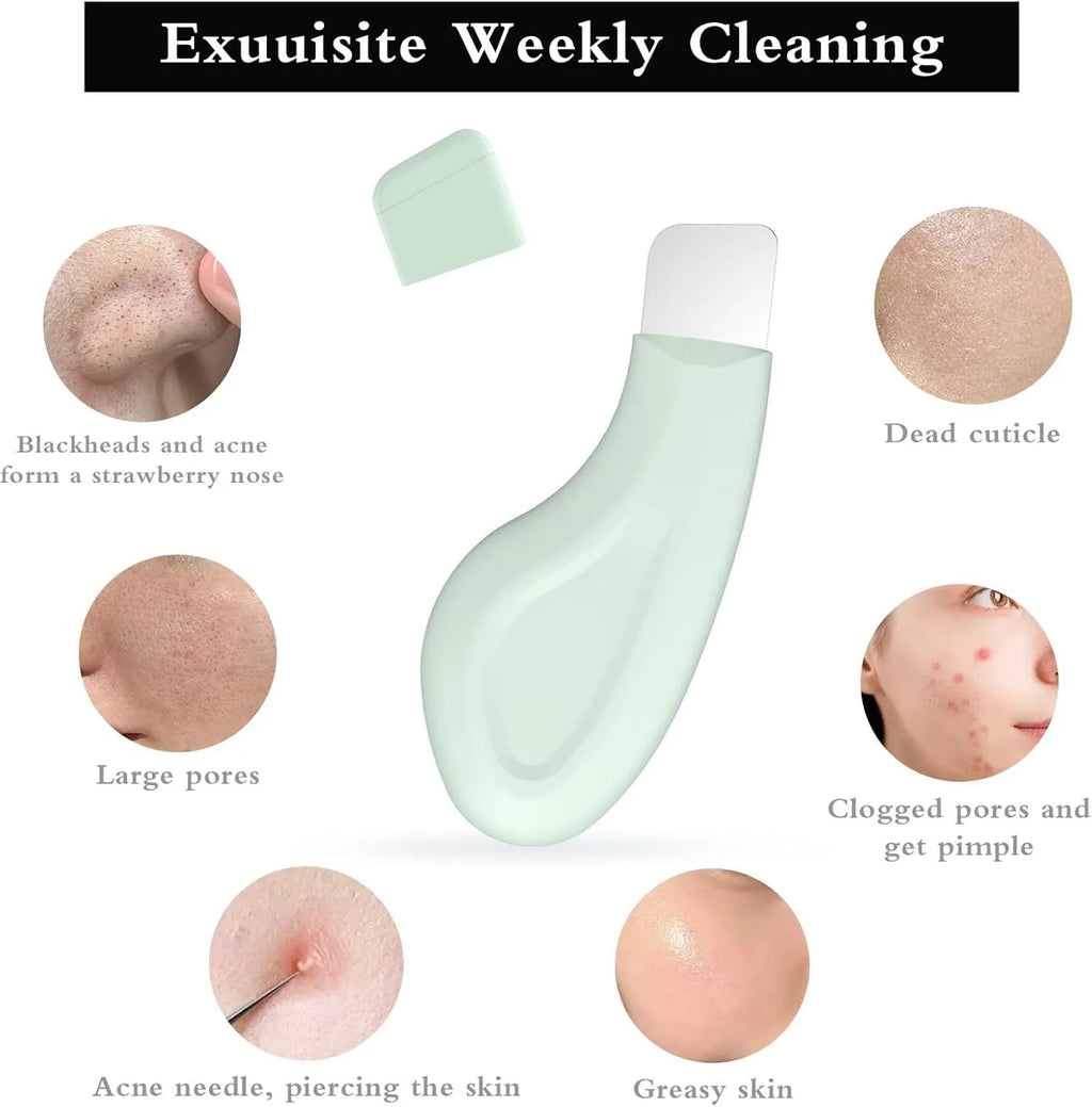 Stainless steel blackhead scraper tool with a non-slip handle for facial pore cleansing.