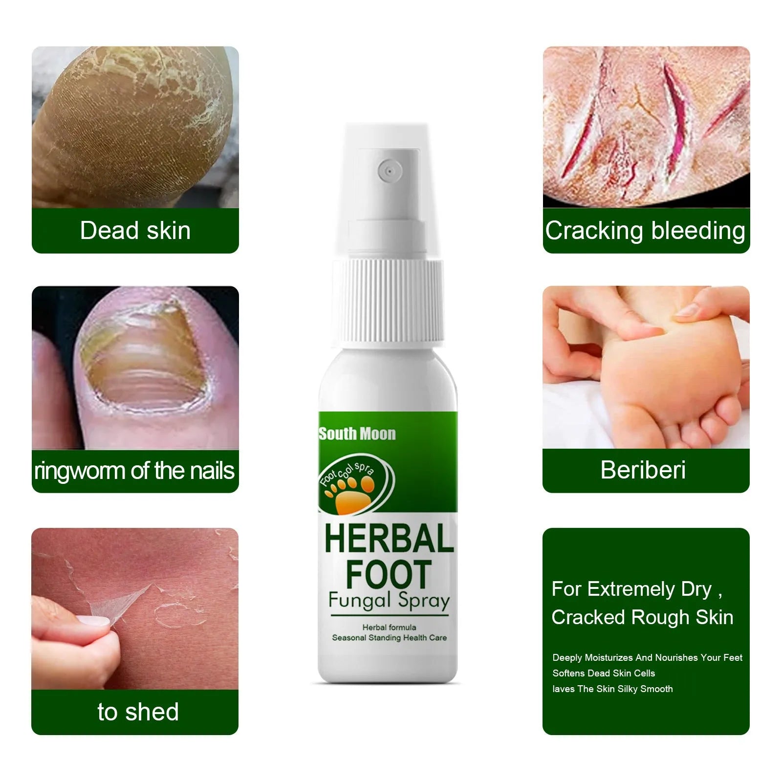 30ml foot spray bottle for skin hydration and nourishment