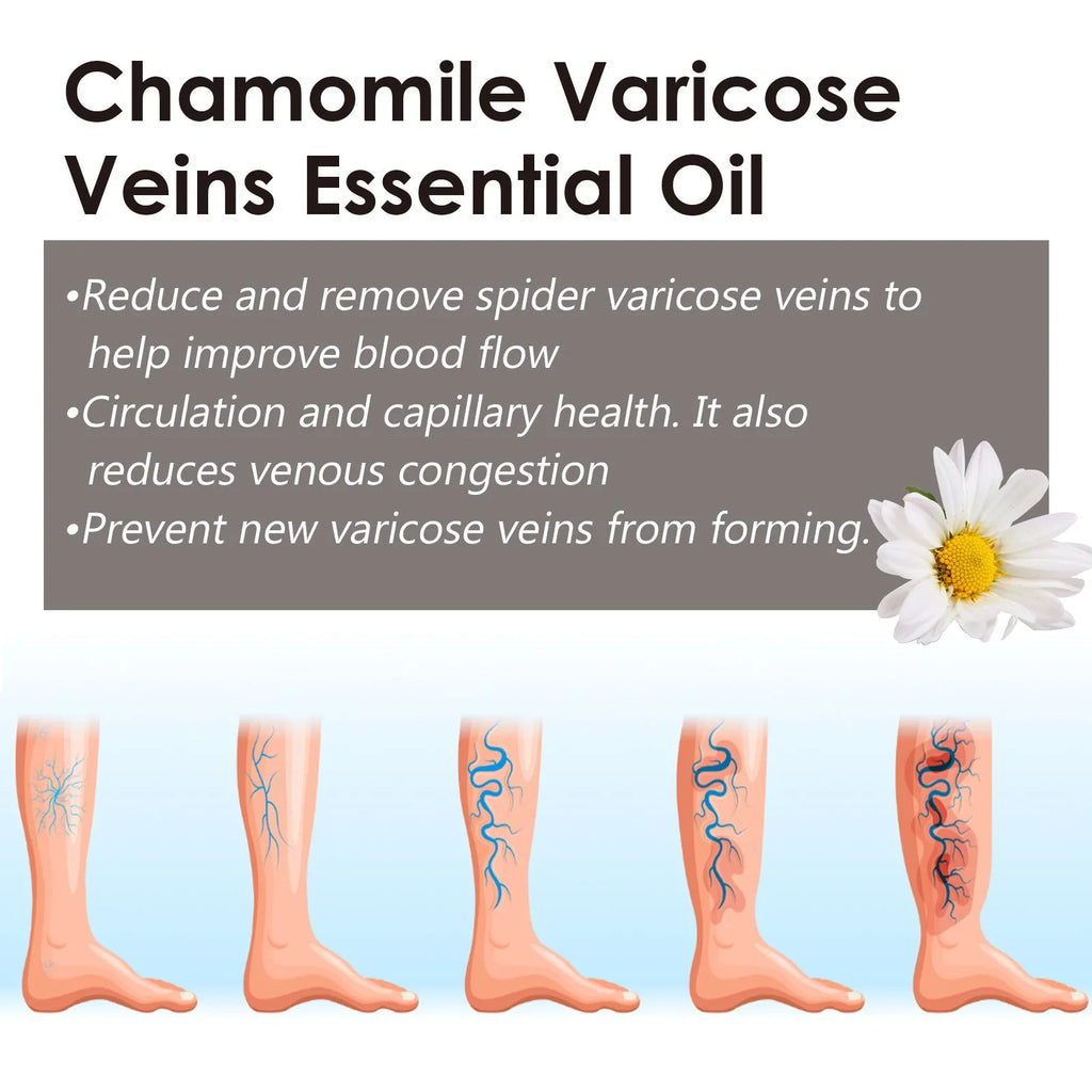 10ml chamomile essential oil bottle for leg massage and skin care
