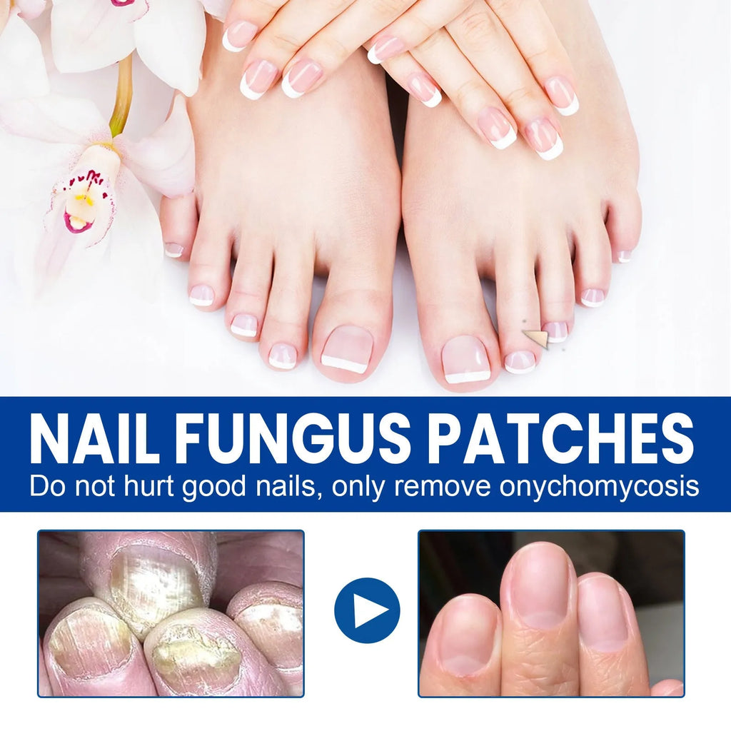 Box of 32 nail repair adhesive bandages with natural ingredients for brittle nails