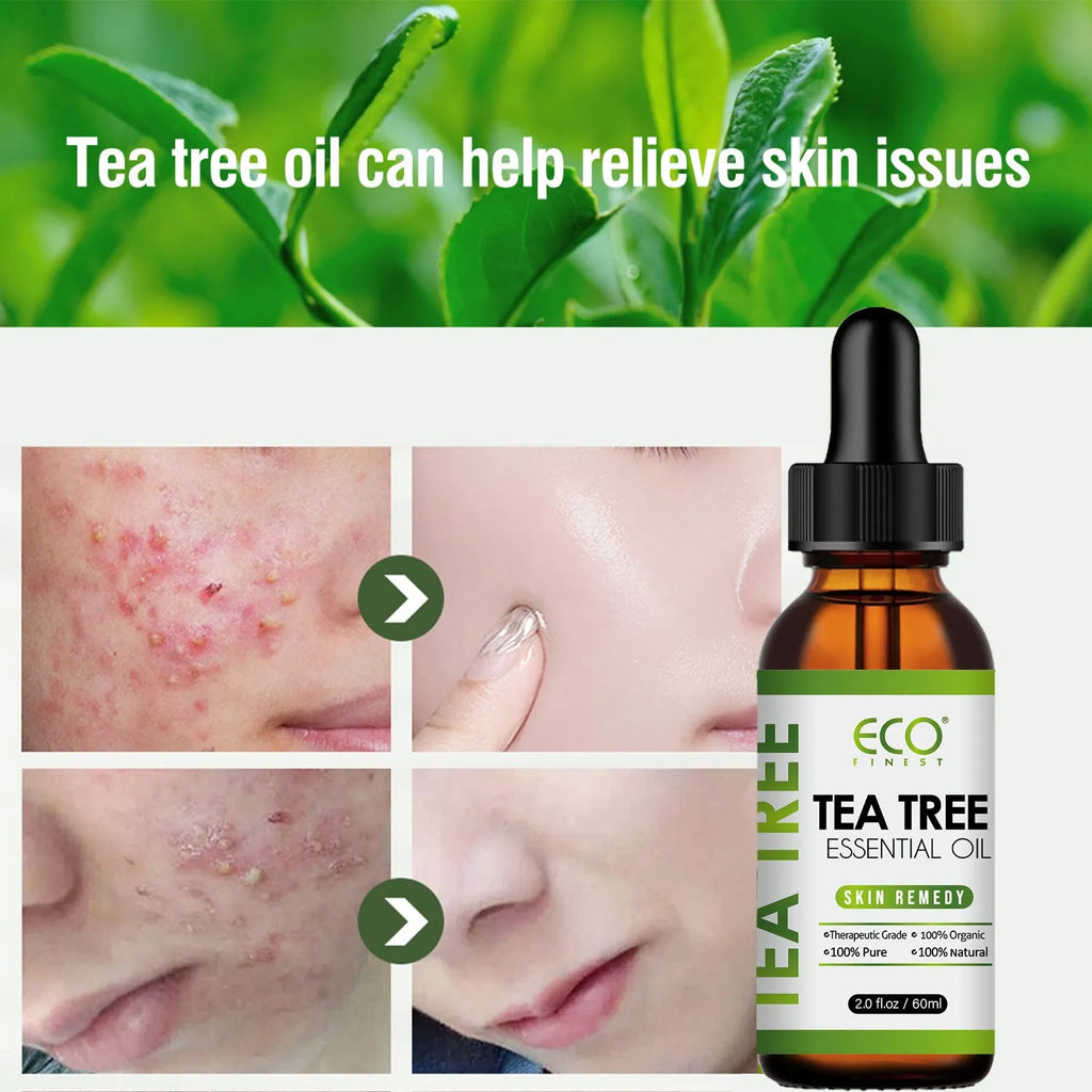 60ml glass bottle of tea tree essential massage oil for facial and skincare treatment.