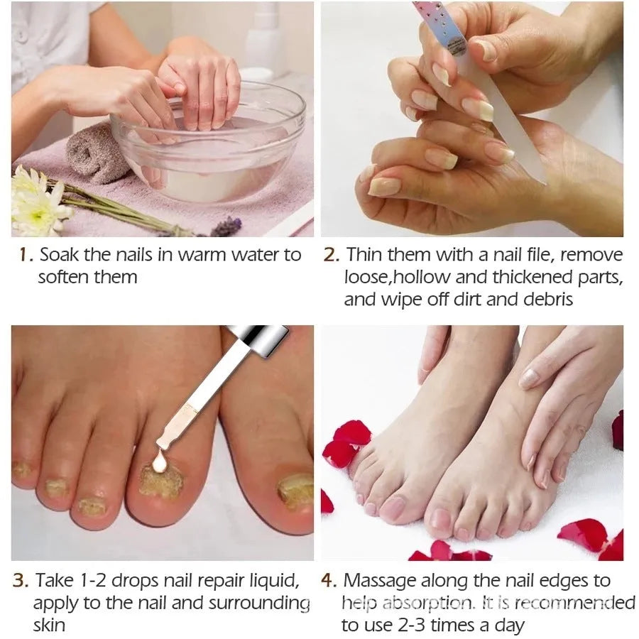 Jiagou 10ml whitening antimicrobial foot treatment liquid bottle