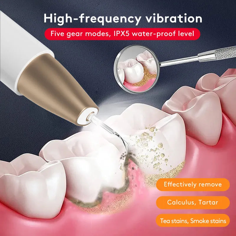 Gold-finish ultrasonic tooth cleaning device for removing tartar and surface stains.