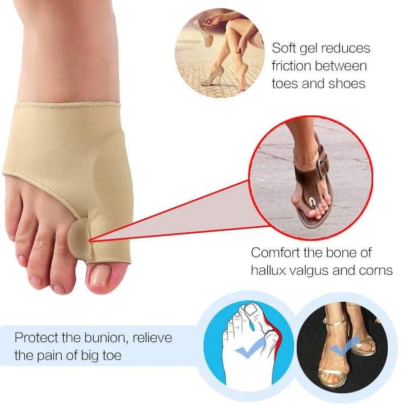 Corrective toe socks with silicone gel bunion pad and toe separator on a foot.