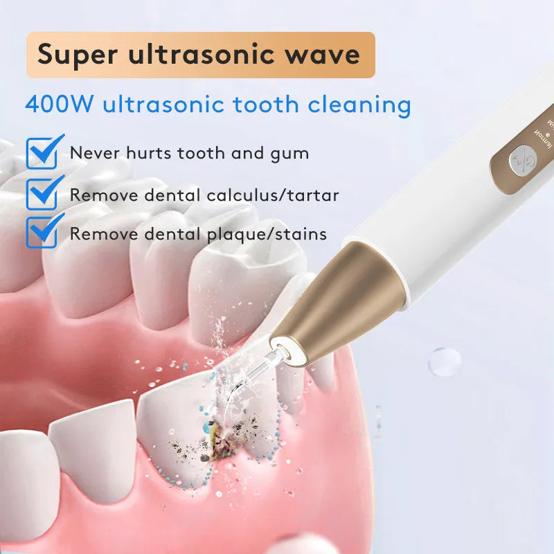 Gold-finish ultrasonic tooth cleaning device for removing tartar and surface stains.