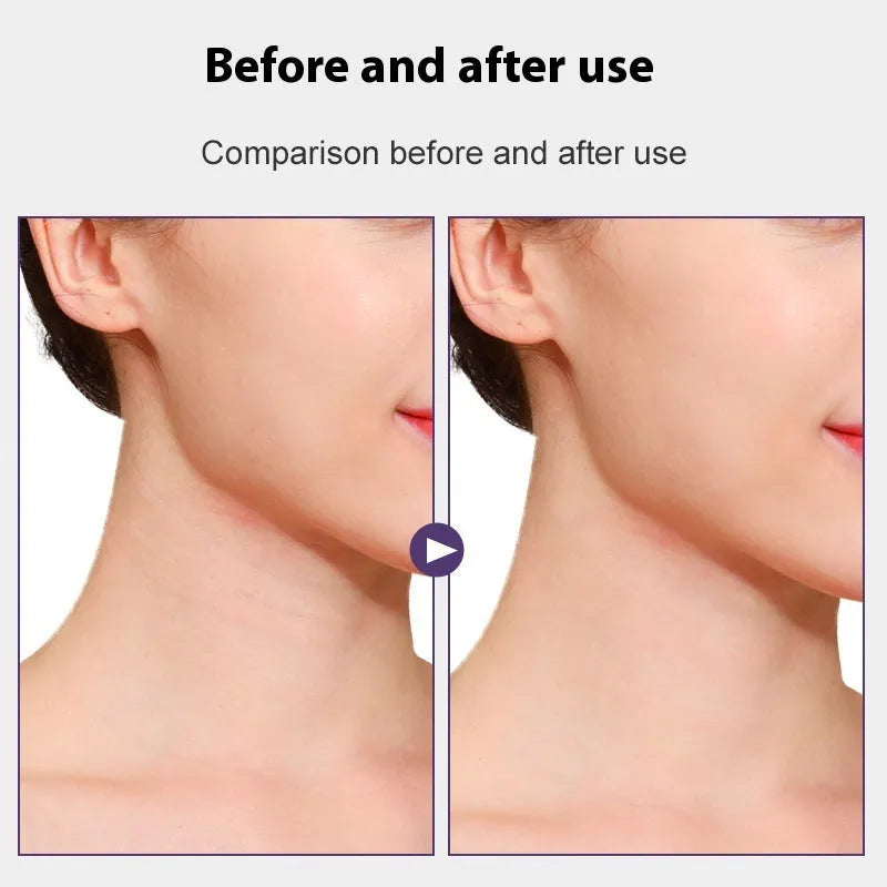 Skin colour neck firming adhesive tape set with four slings and twenty patches.