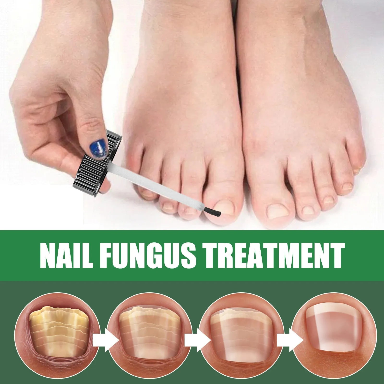 30ml tea tree oil nail repair fluid bottle for thick soft fingernail and toenail treatment