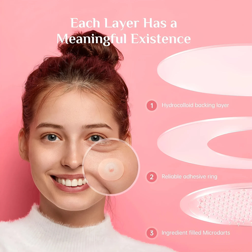 Box containing 9 acne patches for treating pimple and closed mouth acne with desalting function