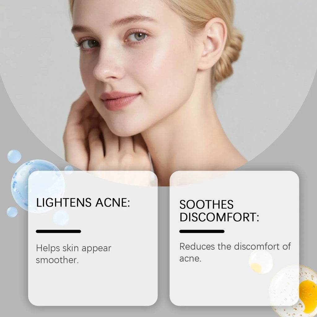 Hydrocolloid facial acne patches in pack of 80 for blemish treatment