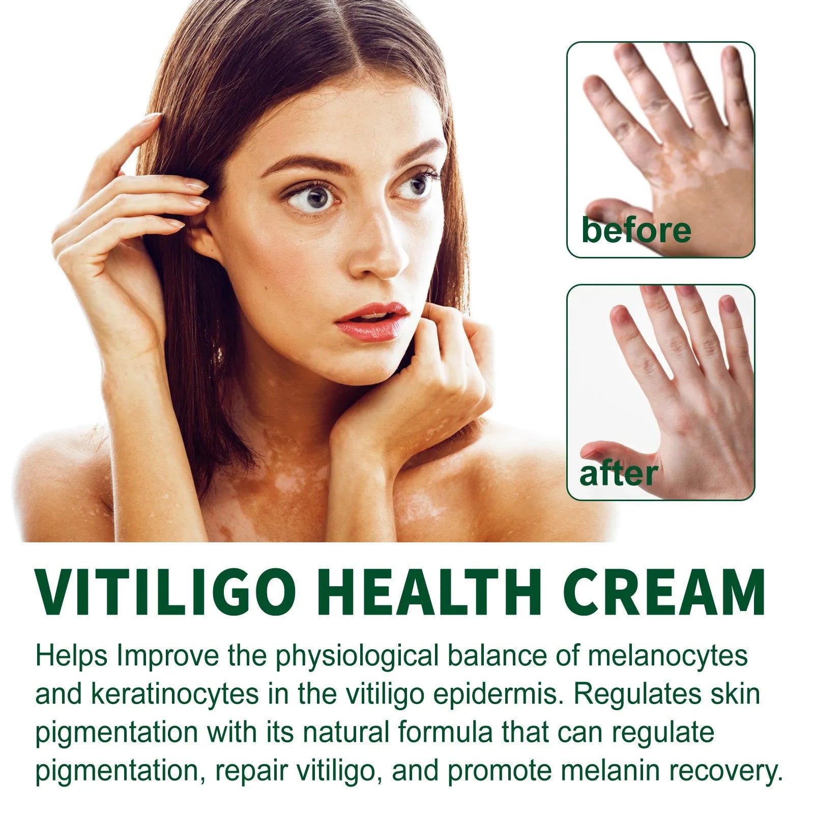 35g body care nursing cream for cleansing, moisturising and orange peel tissue improvement