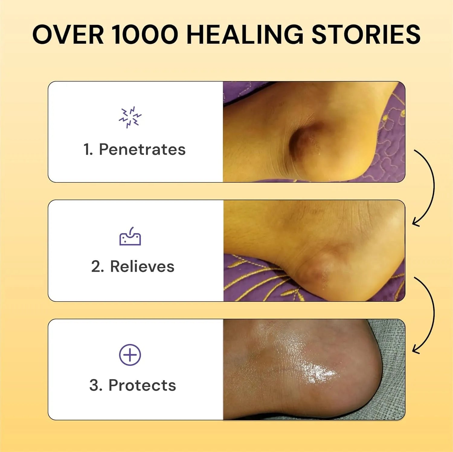 120g tube of Universal Flare Care muscle and joint pain relief cream with no logo on packaging