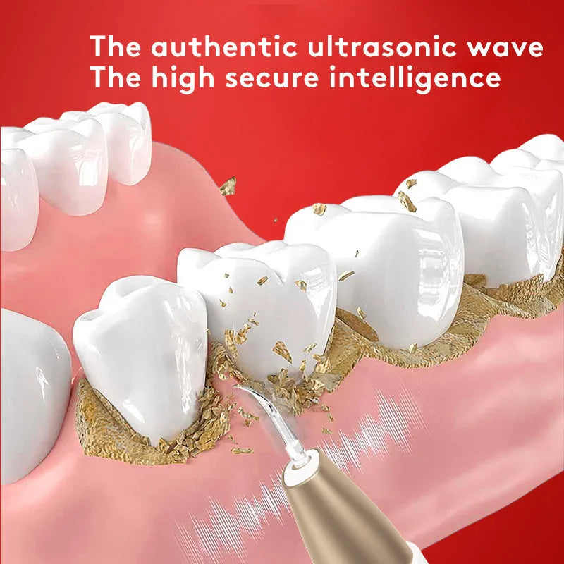 Gold-finish ultrasonic tooth cleaning device for removing tartar and surface stains.